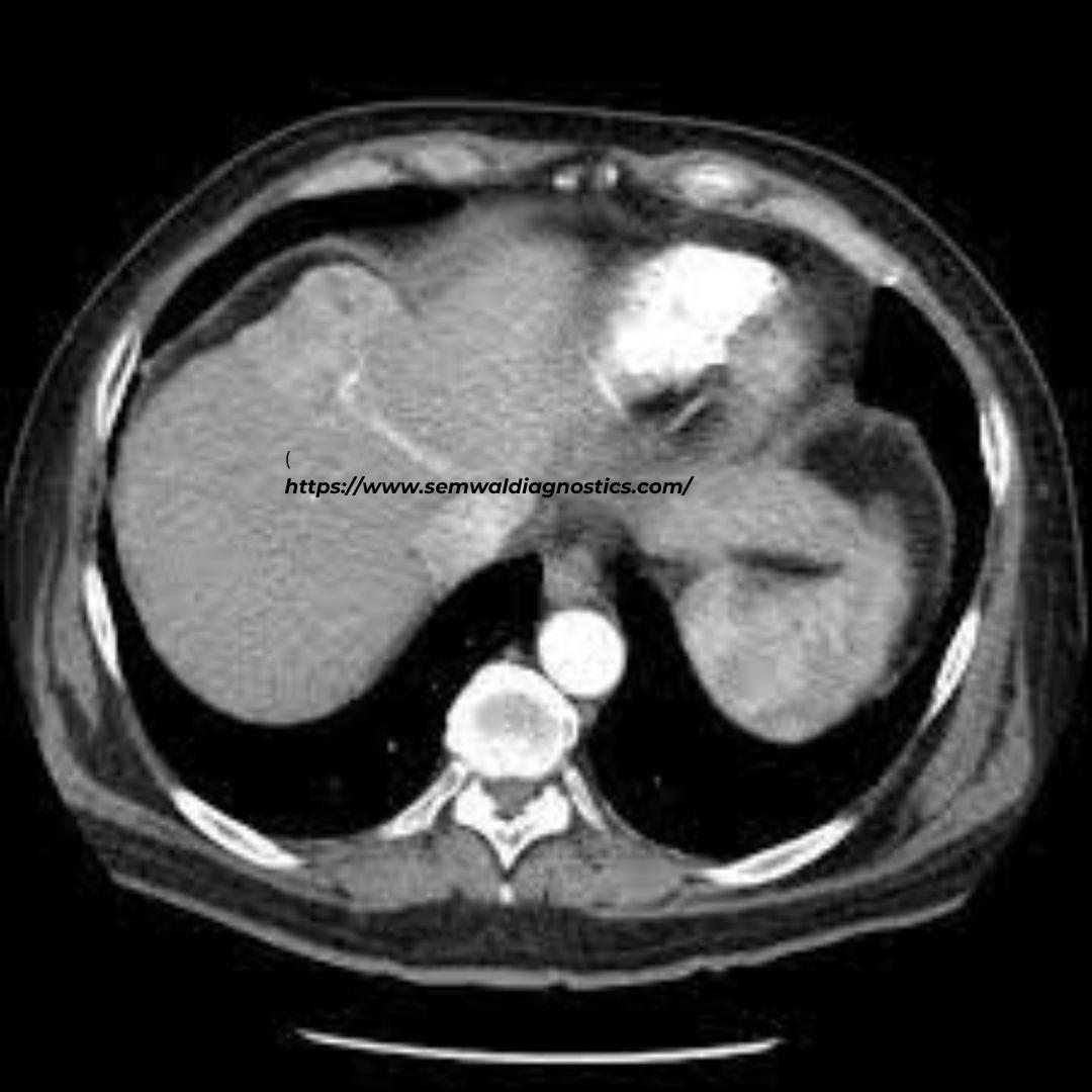 Triple Phase Ct Liver Revolutionizing Diagnostic Imaging 2917