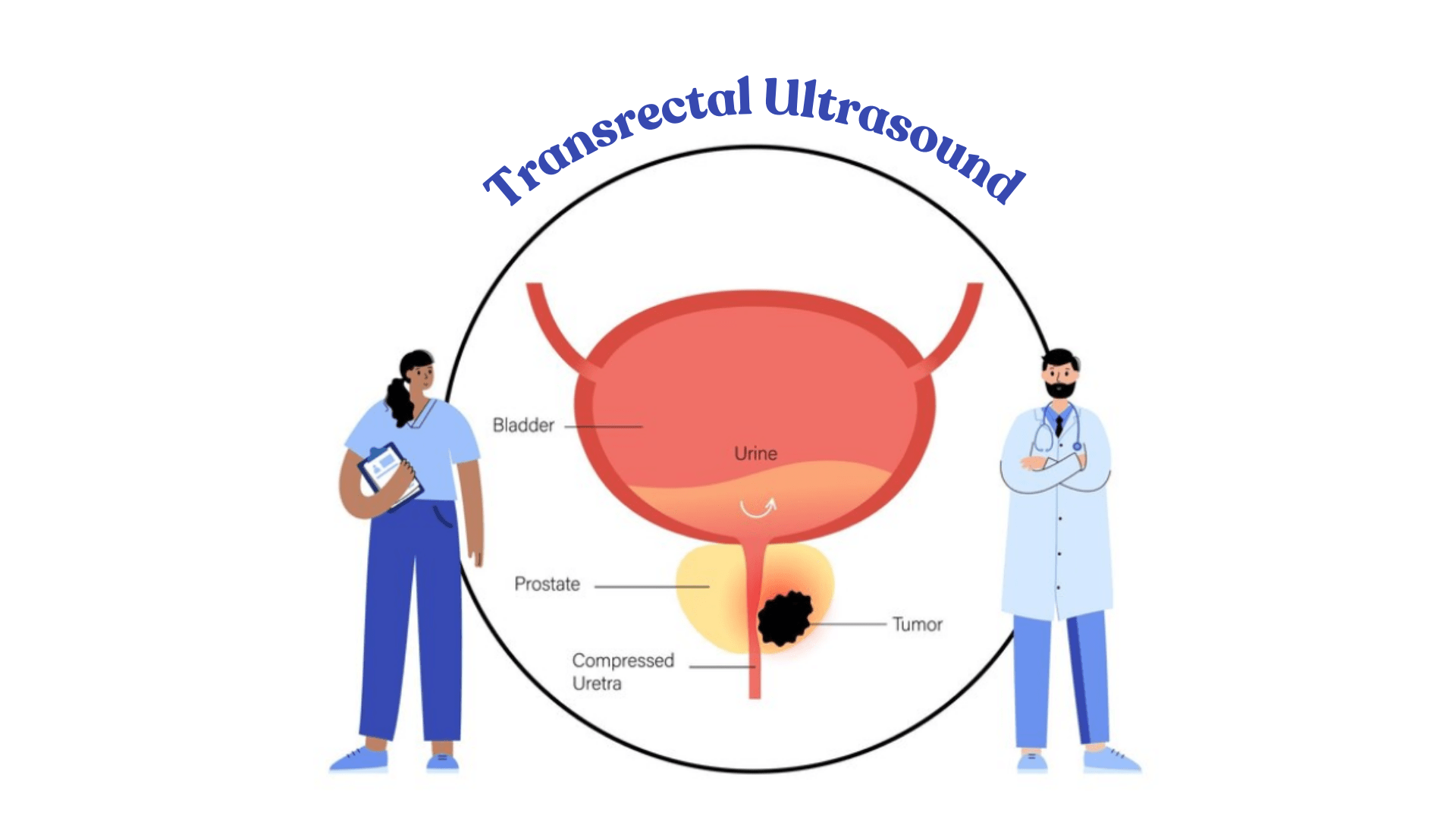 Be Aware of Transrectal Ultrasound | Semwal Diagnostics